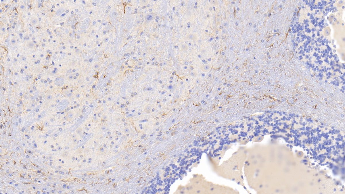 Monoclonal Antibody to Glial Fibrillary Acidic Protein (GFAP)