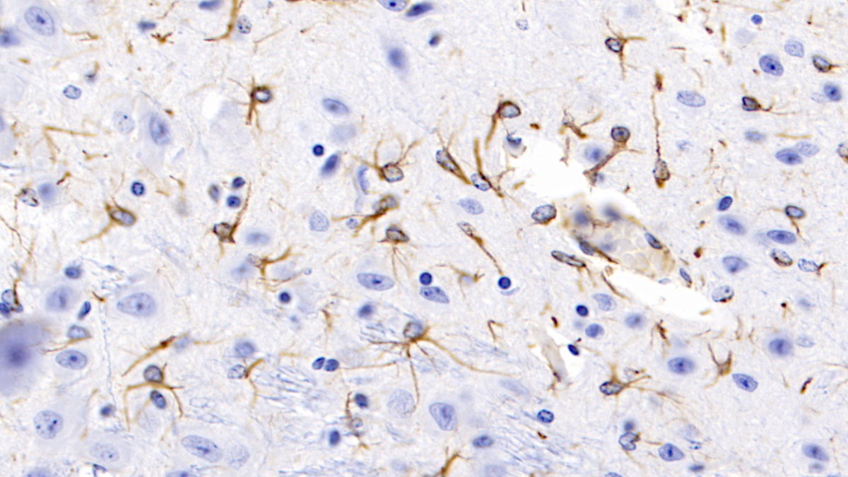 Monoclonal Antibody to Glial Fibrillary Acidic Protein (GFAP)