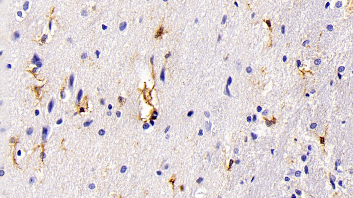 Monoclonal Antibody to Glial Fibrillary Acidic Protein (GFAP)