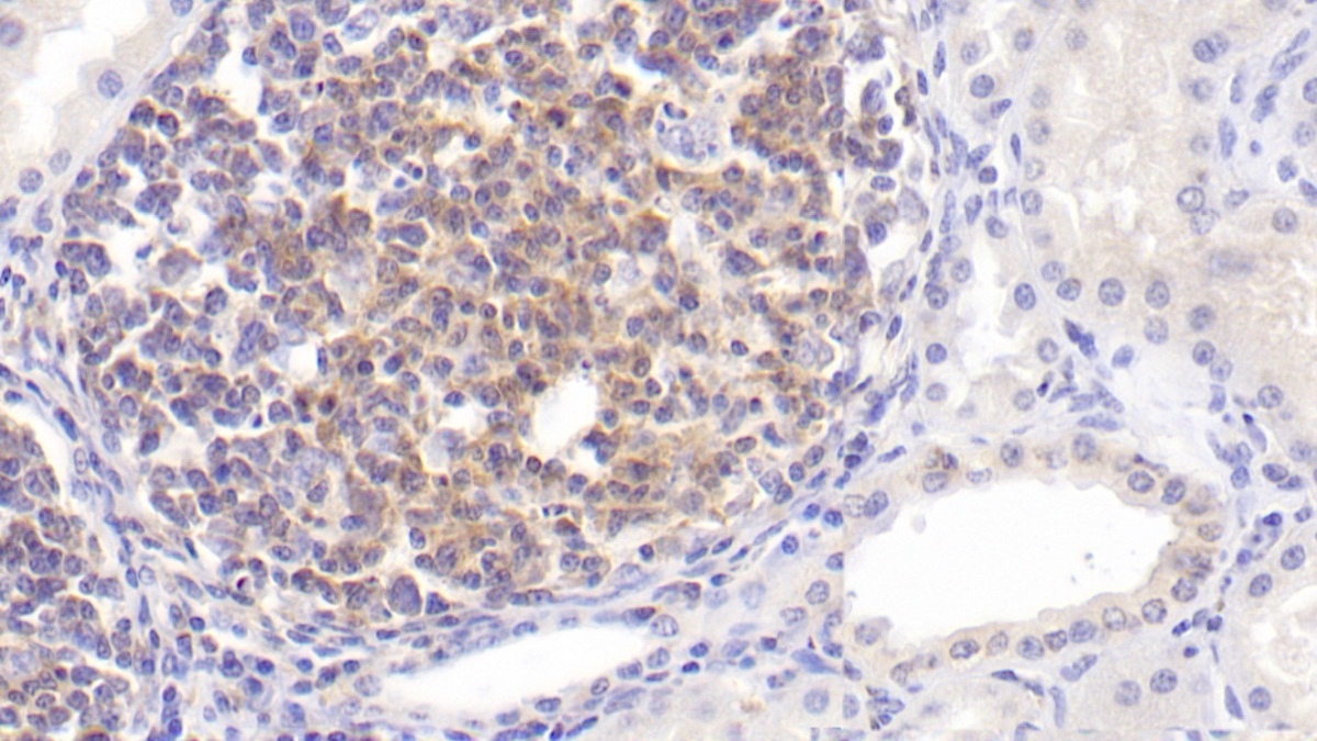 Monoclonal Antibody to Interleukin 2 (IL2)