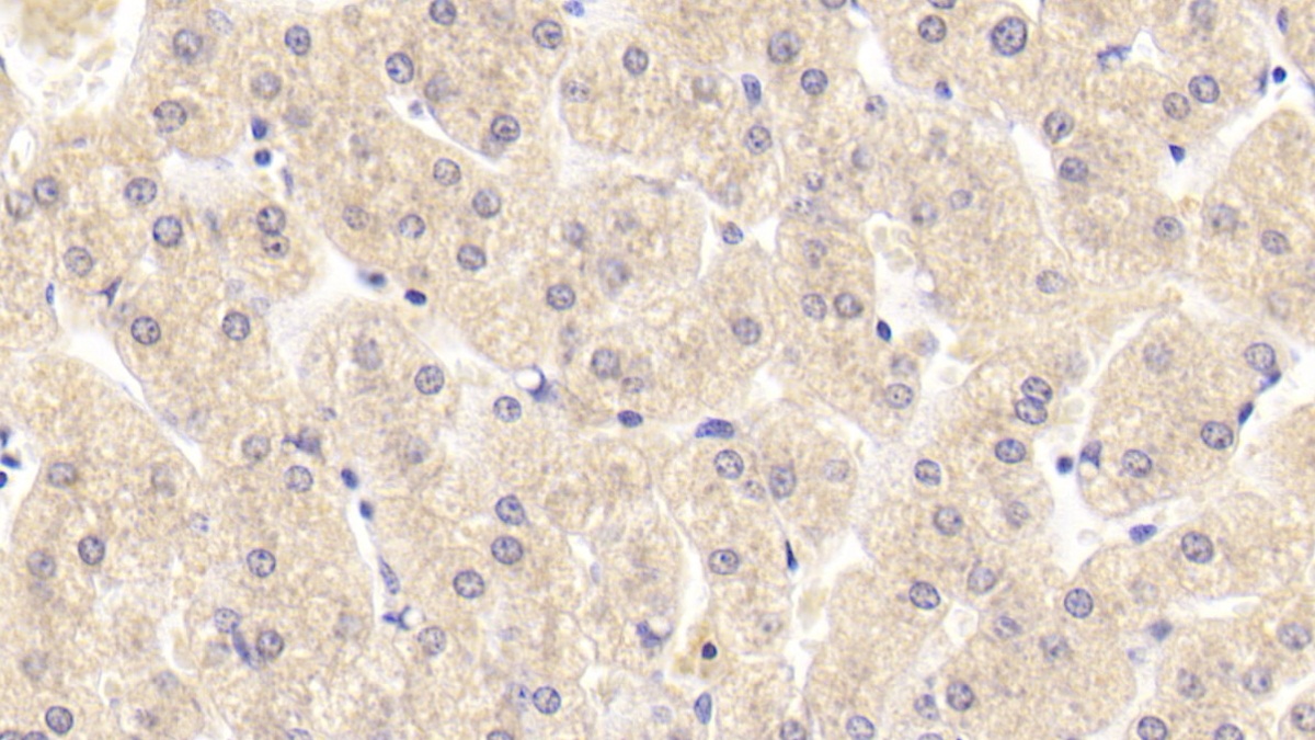 Monoclonal Antibody to Interleukin 5 (IL5)