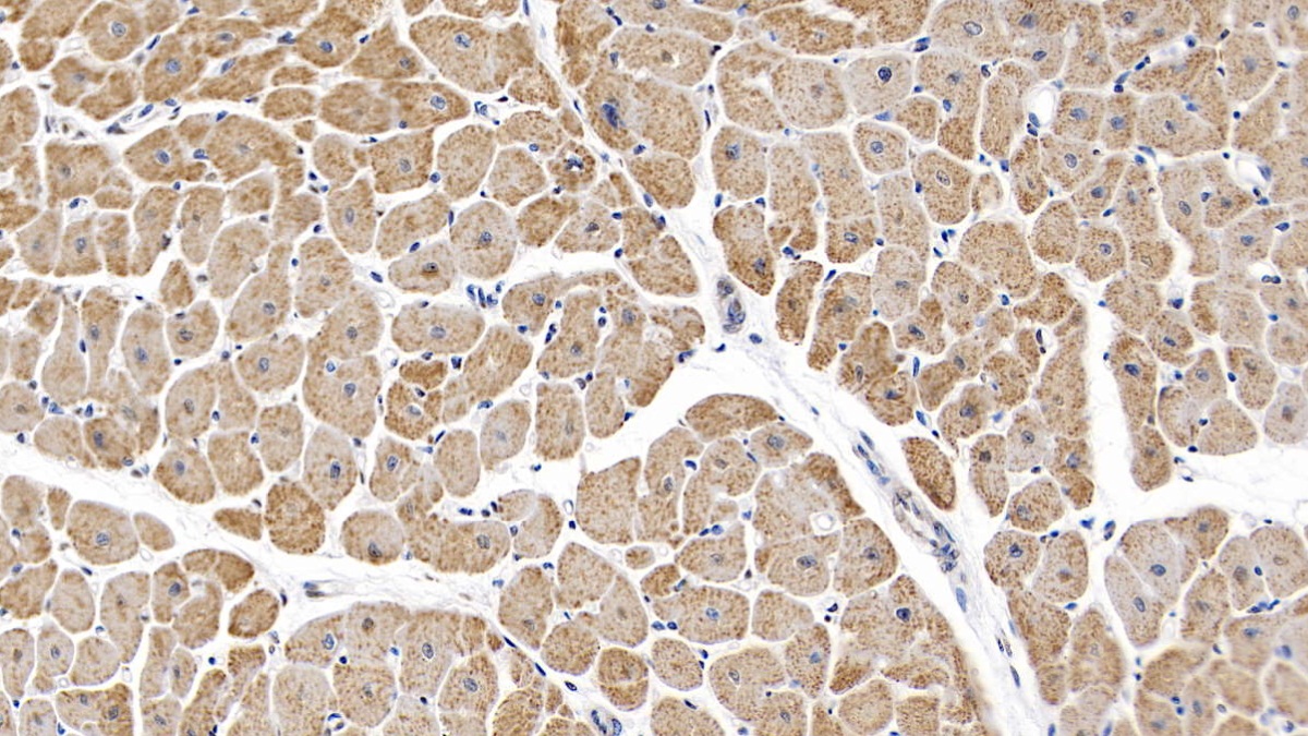 Monoclonal Antibody to Interleukin 6 (IL6)