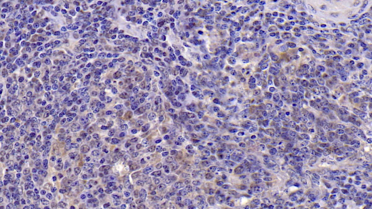 Monoclonal Antibody to Interleukin 6 (IL6)