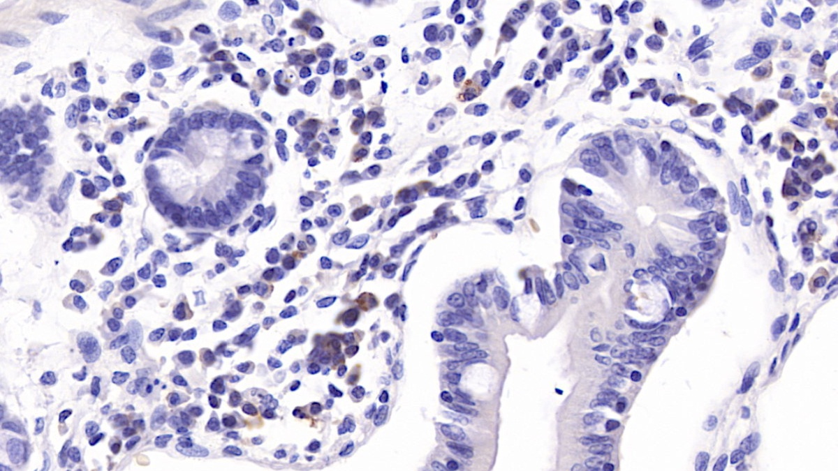 Monoclonal Antibody to Interleukin 6 (IL6)