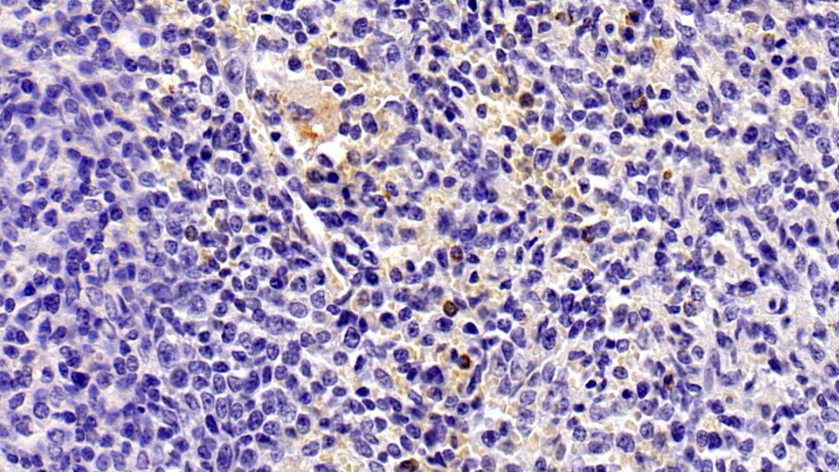 Monoclonal Antibody to Interleukin 8 (IL8)