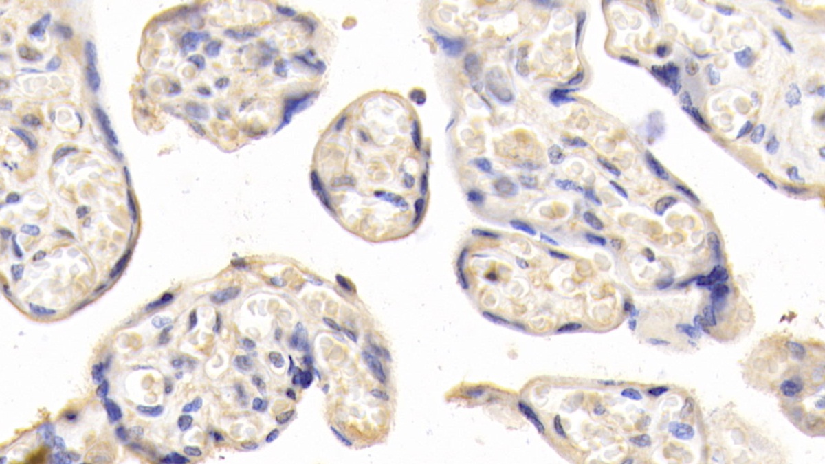 Monoclonal Antibody to Leptin (LEP)