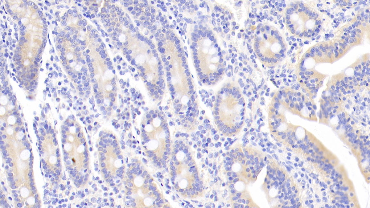 Monoclonal Antibody to Leukemia Inhibitory Factor (LIF)