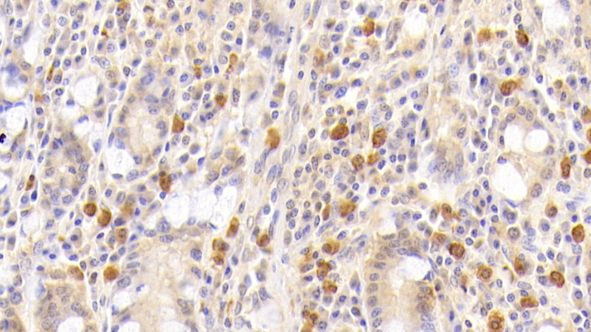 Monoclonal Antibody to Leukemia Inhibitory Factor (LIF)