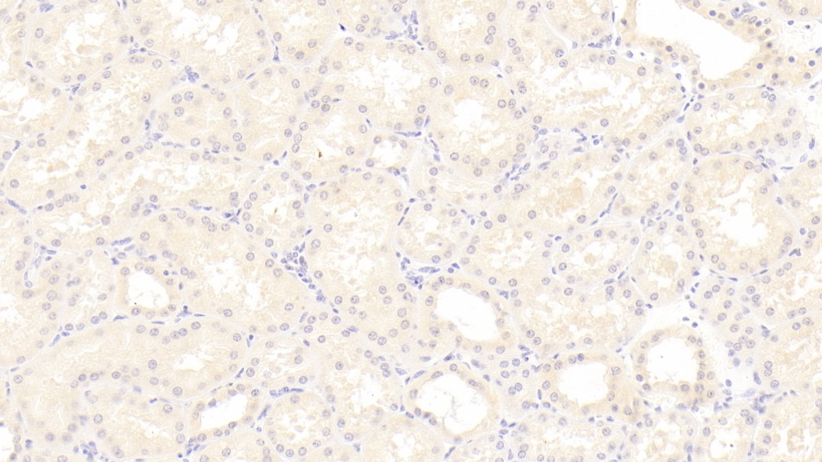 Monoclonal Antibody to Monocyte Chemotactic Protein 1 (MCP1)