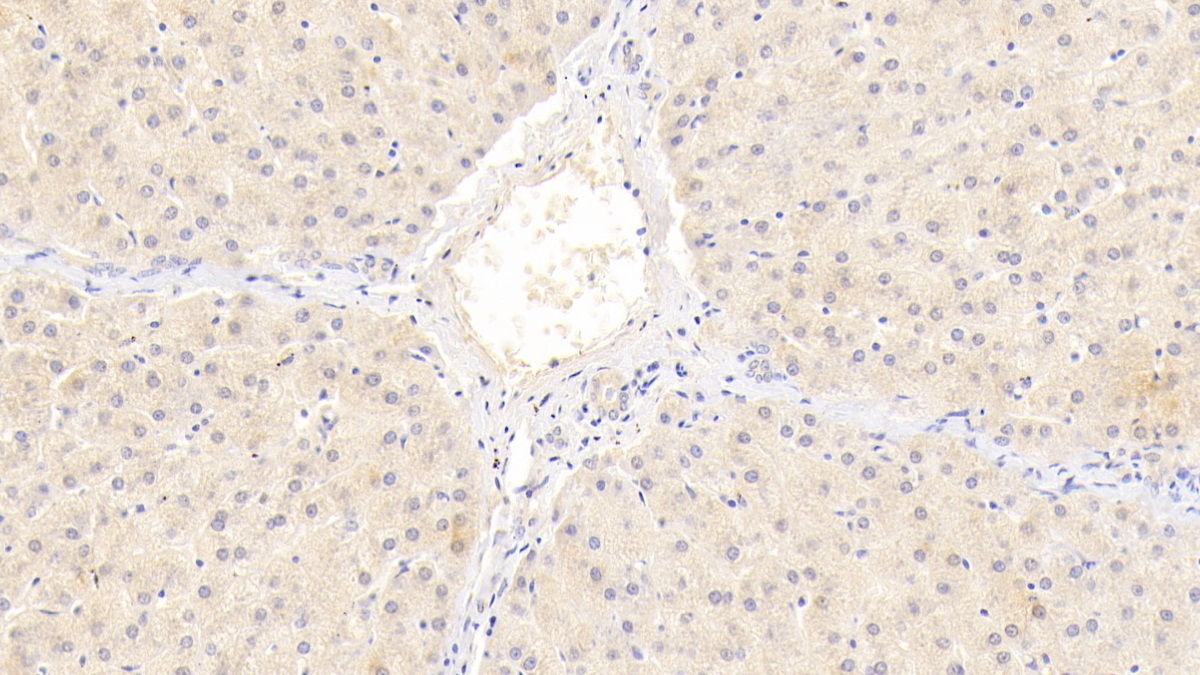 Monoclonal Antibody to Matrix Metalloproteinase 2 (MMP2)