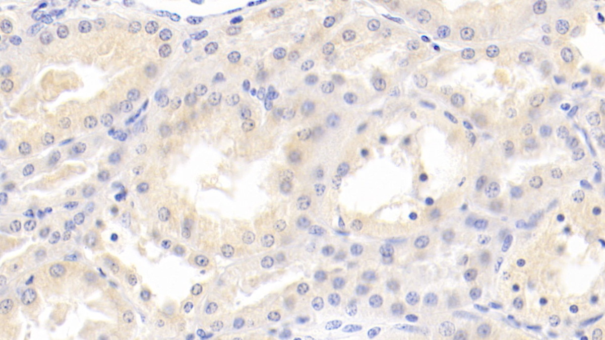 Monoclonal Antibody to Matrix Metalloproteinase 7 (MMP7)