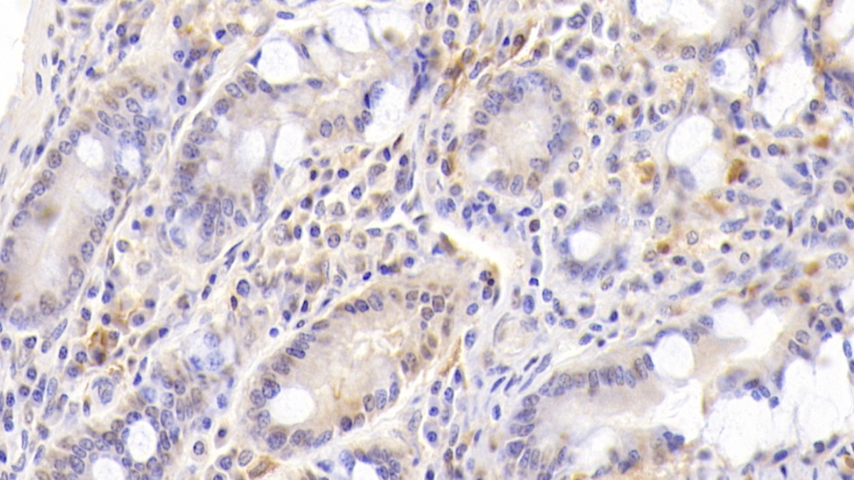 Monoclonal Antibody to Matrix Metalloproteinase 7 (MMP7)