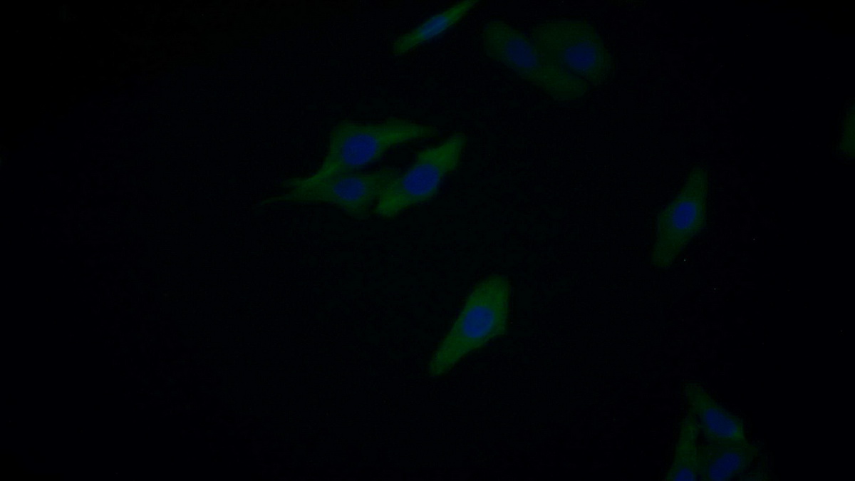 Monoclonal Antibody to Nerve Growth Factor (NGF)