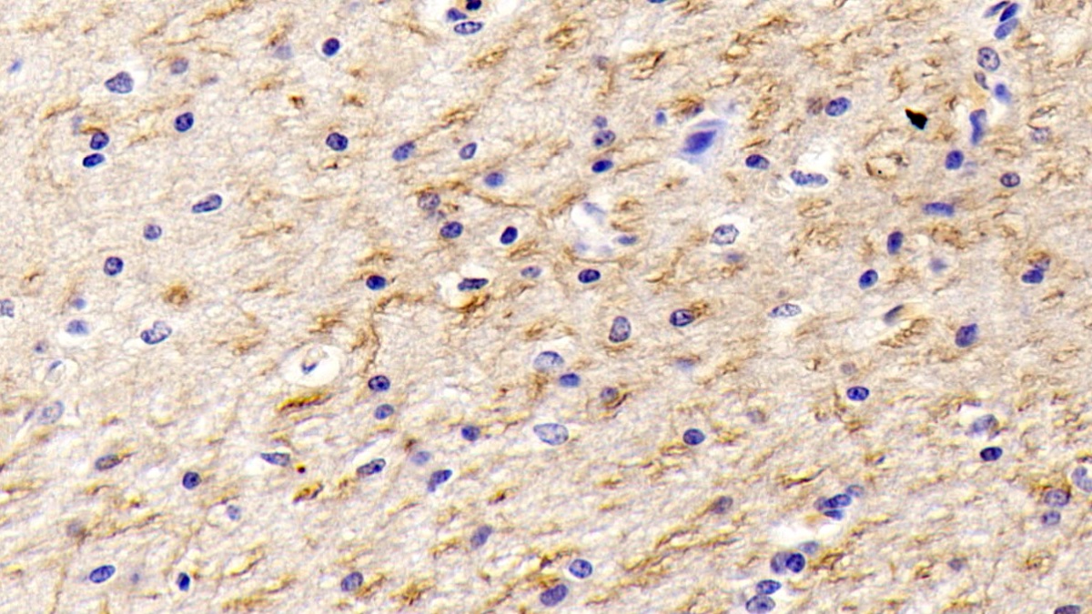 Monoclonal Antibody to Nerve Growth Factor (NGF)