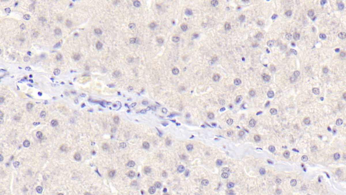 Monoclonal Antibody to Osteoprotegerin (OPG)