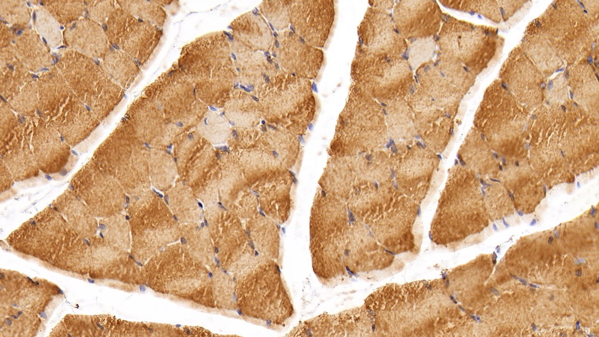 Monoclonal Antibody to Creatine Kinase, Muscle (CKM)