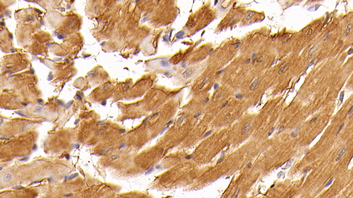 Monoclonal Antibody to Creatine Kinase, Muscle (CKM)