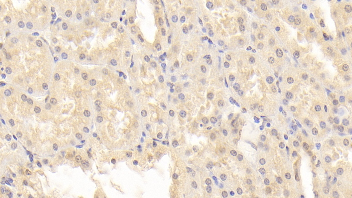 Monoclonal Antibody to Superoxide Dismutase 3, Extracellular (SOD3)