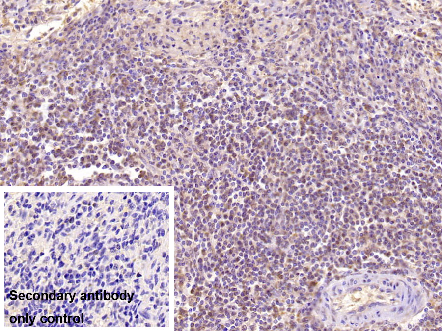 Monoclonal Antibody to Superoxide Dismutase 3, Extracellular (SOD3)