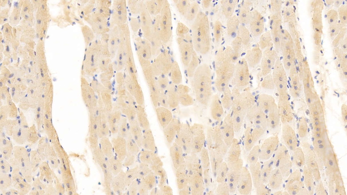 Monoclonal Antibody to Cluster Of Differentiation 40 Ligand (CD40L)