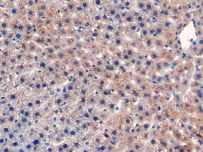 Monoclonal Antibody to Cluster Of Differentiation 40 Ligand (CD40L)