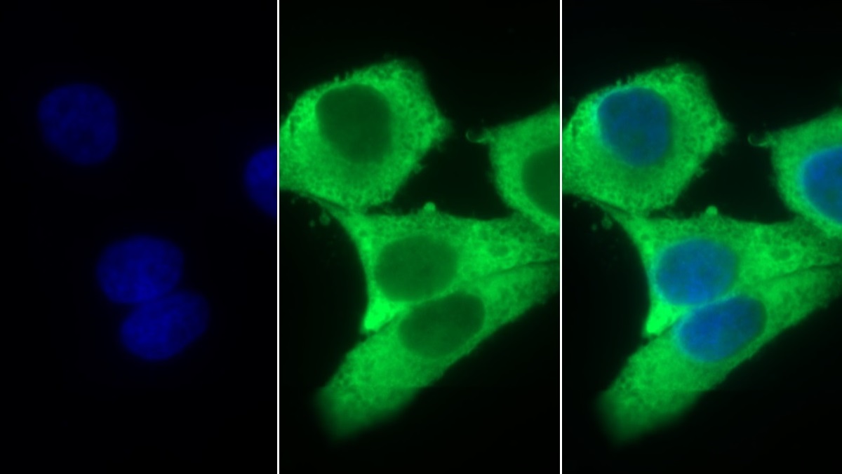 Monoclonal Antibody to Stem Cell Factor Receptor (SCFR)