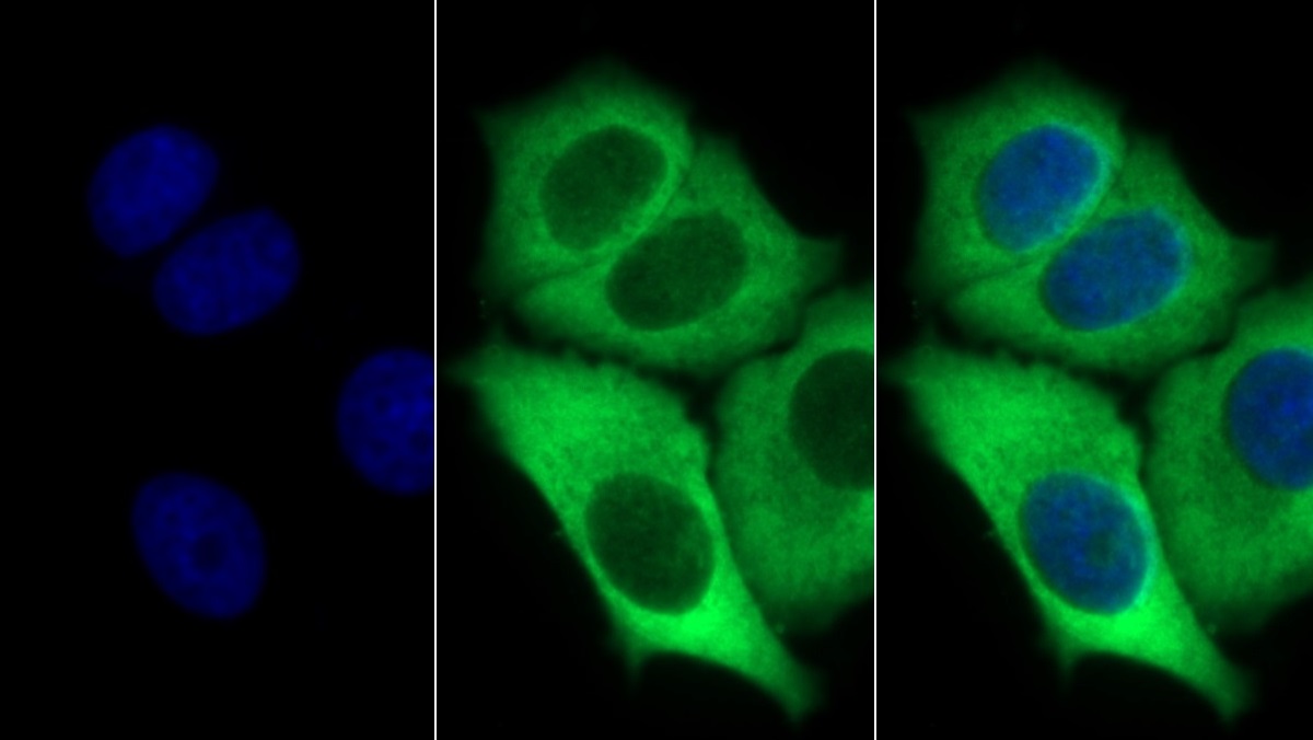 Monoclonal Antibody to Stem Cell Factor Receptor (SCFR)