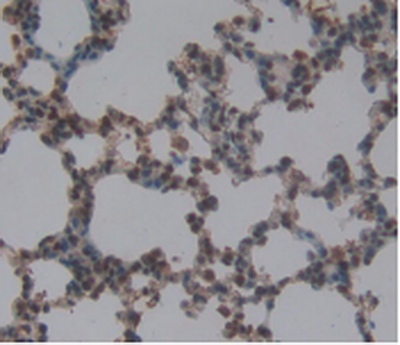 Monoclonal Antibody to Stem Cell Factor Receptor (SCFR)