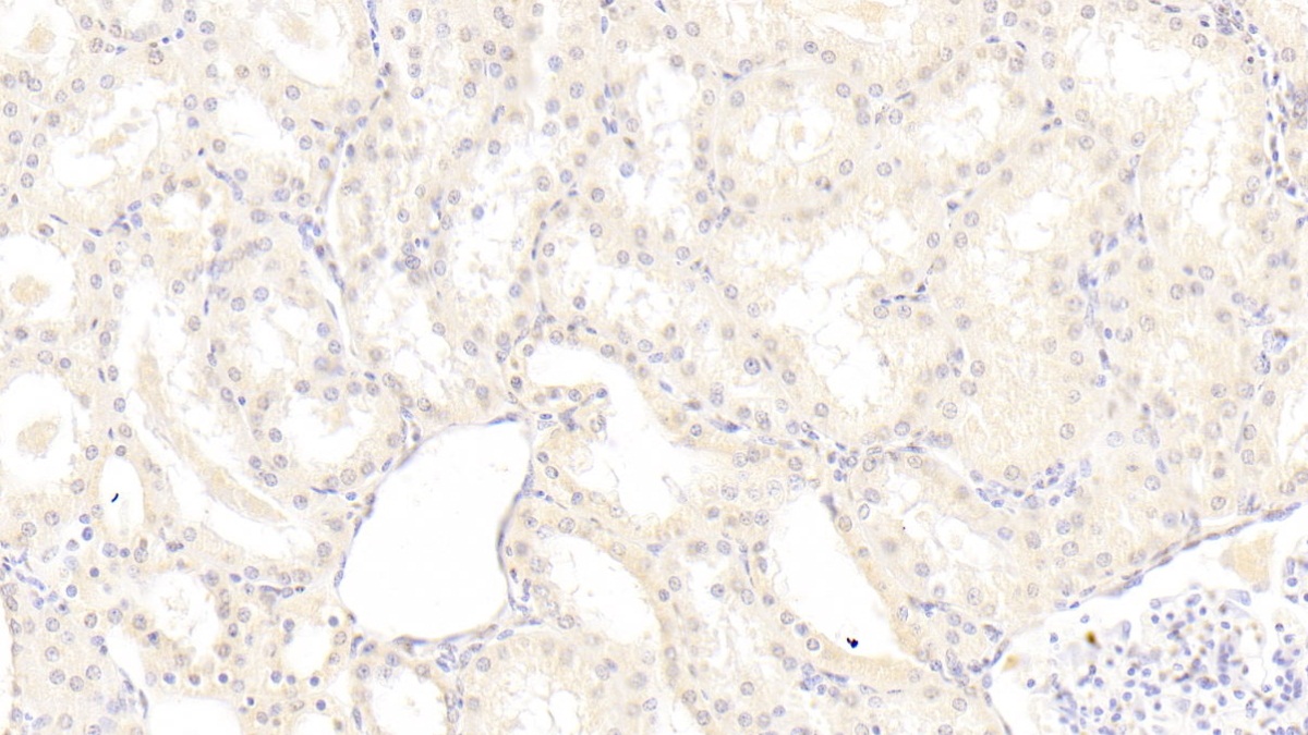 Monoclonal Antibody to Transforming Growth Factor Alpha (TGFa)