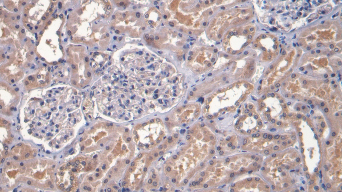 Monoclonal Antibody to Transforming Growth Factor Beta 1 (TGFb1)