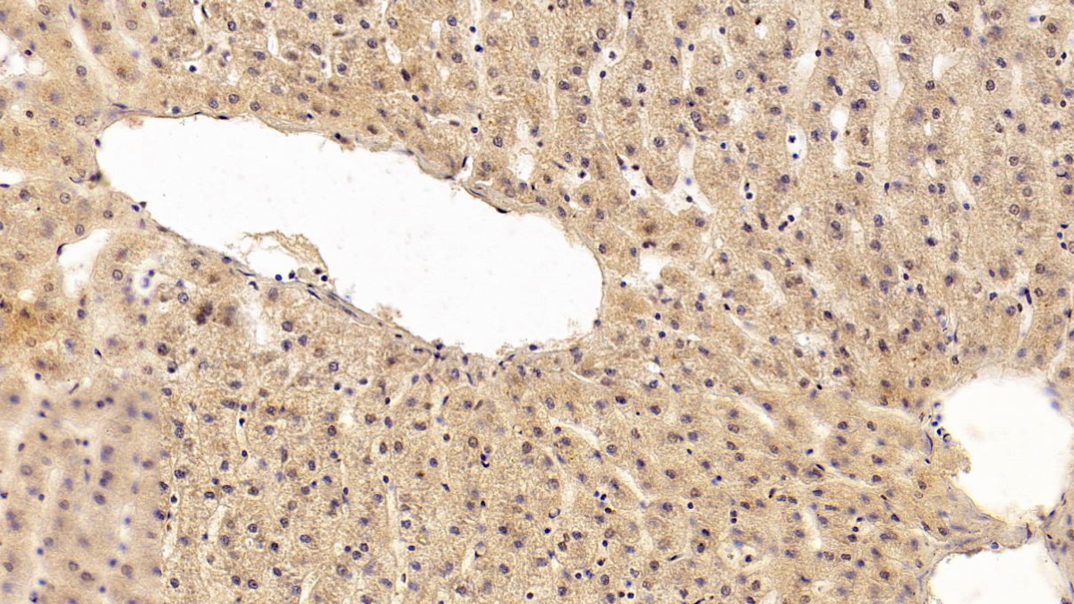 Monoclonal Antibody to Transforming Growth Factor Beta 1 (TGFb1)