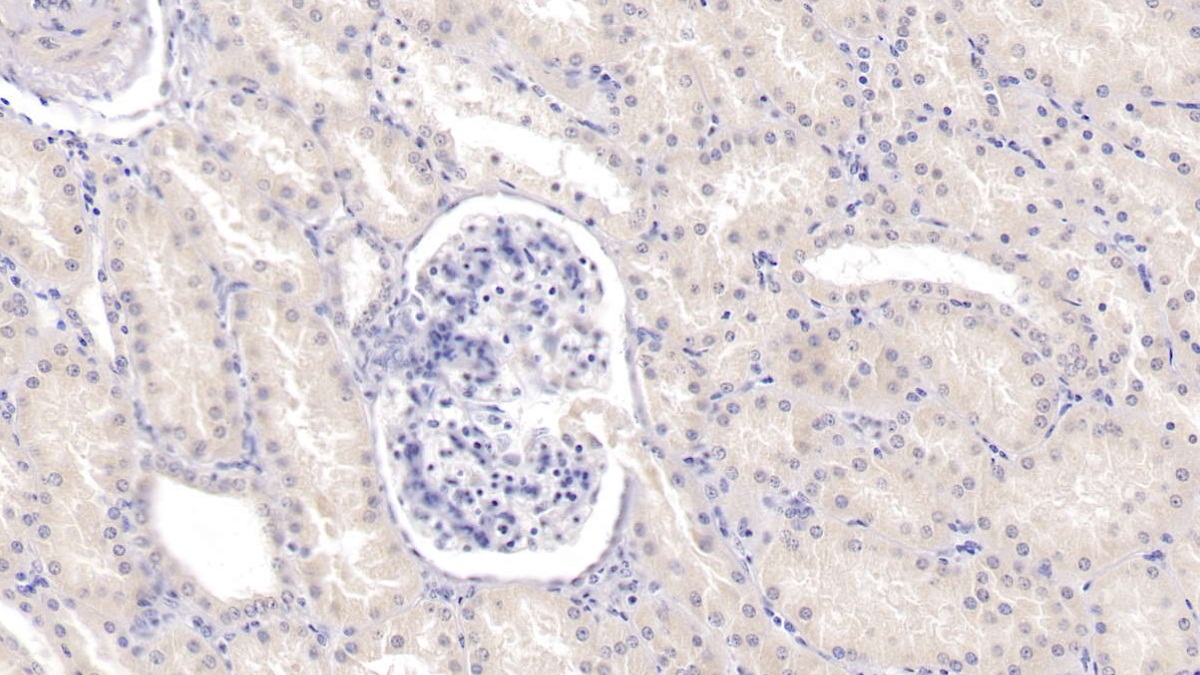 Monoclonal Antibody to Tyrosine Kinase With Immunoglobulin Like And EGF Like Domains Protein 1 (Tie1)