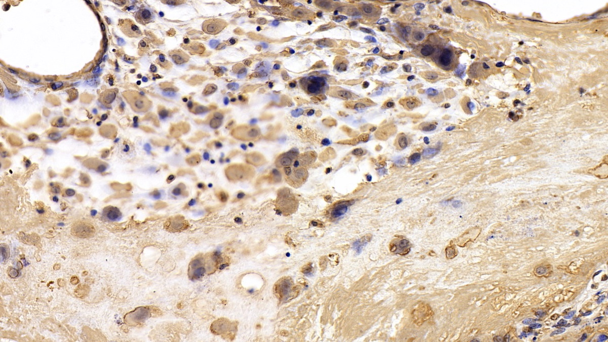 Monoclonal Antibody to Tissue Inhibitors Of Metalloproteinase 3 (TIMP3)