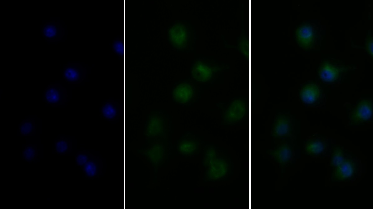 Monoclonal Antibody to Tumor Necrosis Factor Alpha (TNFa)