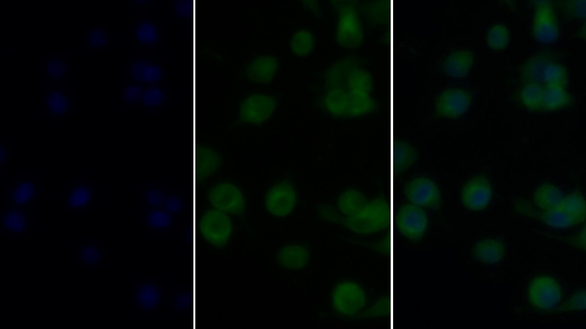 Monoclonal Antibody to Tumor Necrosis Factor Alpha (TNFa)