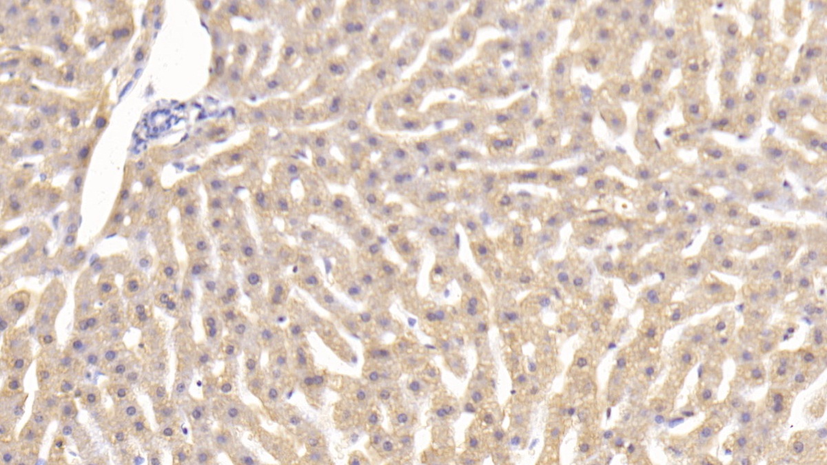 Monoclonal Antibody to Tumor Necrosis Factor Alpha (TNFa)