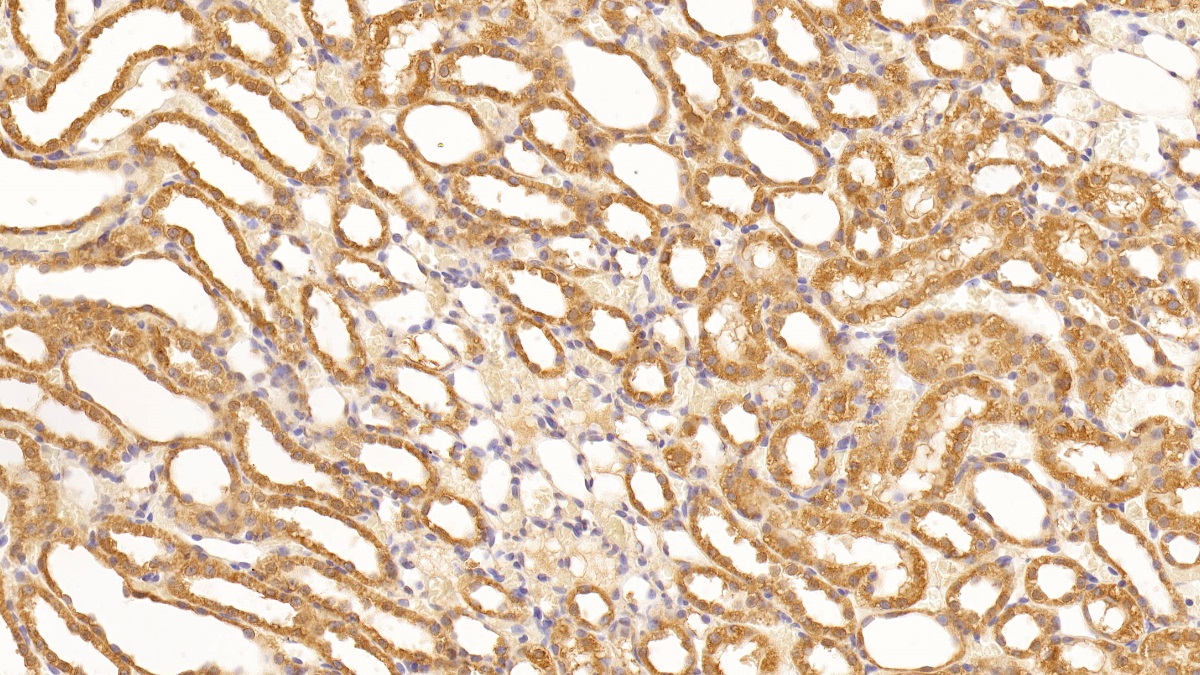 Monoclonal Antibody to Vascular Endothelial Growth Factor A (VEGFA)