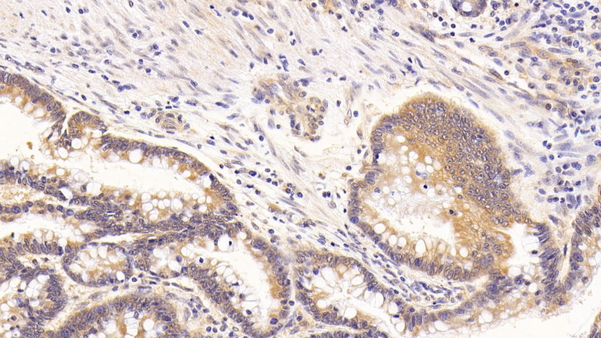 Monoclonal Antibody to Vascular Endothelial Growth Factor C (VEGFC)