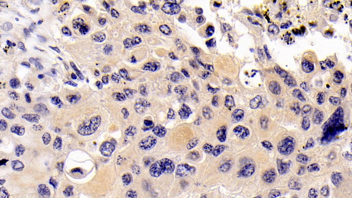 Monoclonal Antibody to Vascular Endothelial Growth Factor C (VEGFC)