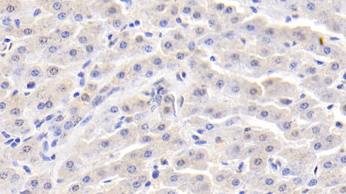 Monoclonal Antibody to Alpha-Fetoprotein (AFP)