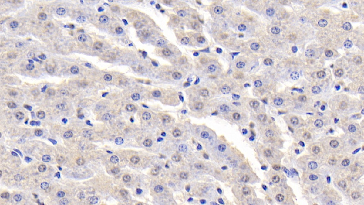 Monoclonal Antibody to Alpha-Fetoprotein (AFP)