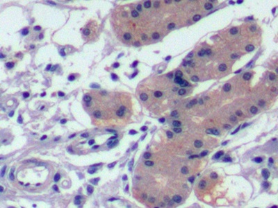 Monoclonal Antibody to Alpha-Fetoprotein (AFP)