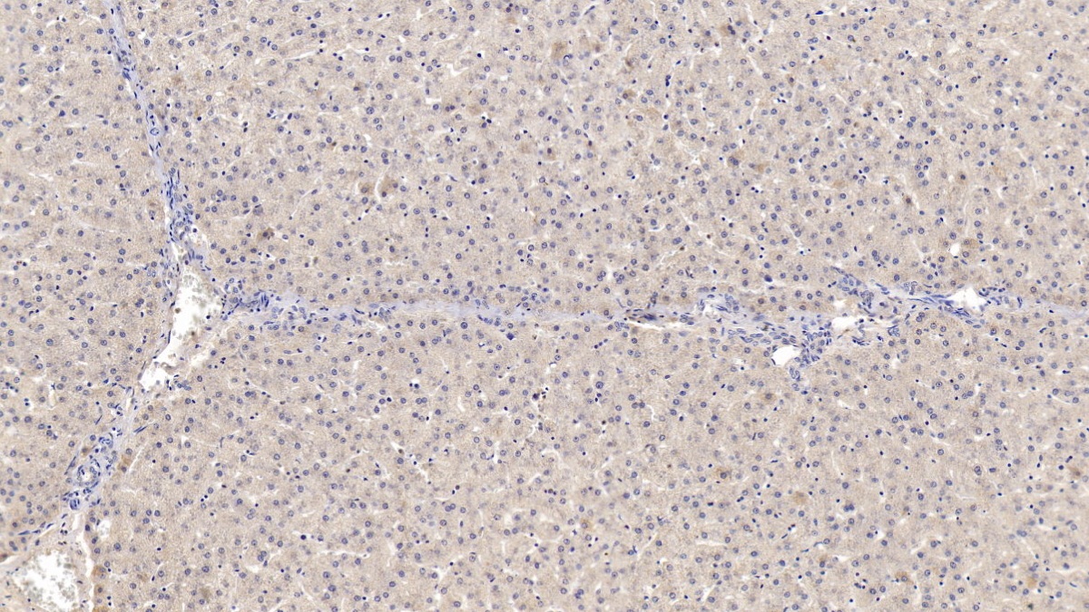 Monoclonal Antibody to Serpin Peptidase Inhibitor,Clade B,Member 4 (SERPINB4)