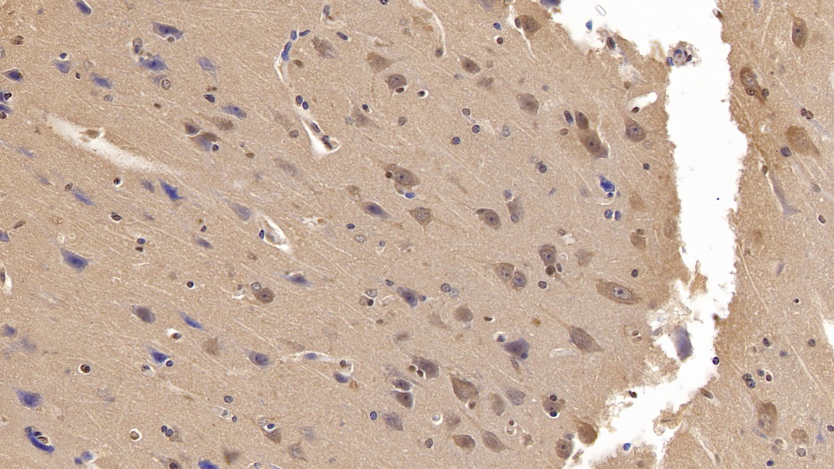 Monoclonal Antibody to Ubiquitin (Ub)