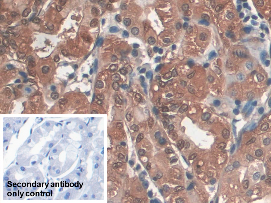 Monoclonal Antibody to Pepsinogen A (PGA)