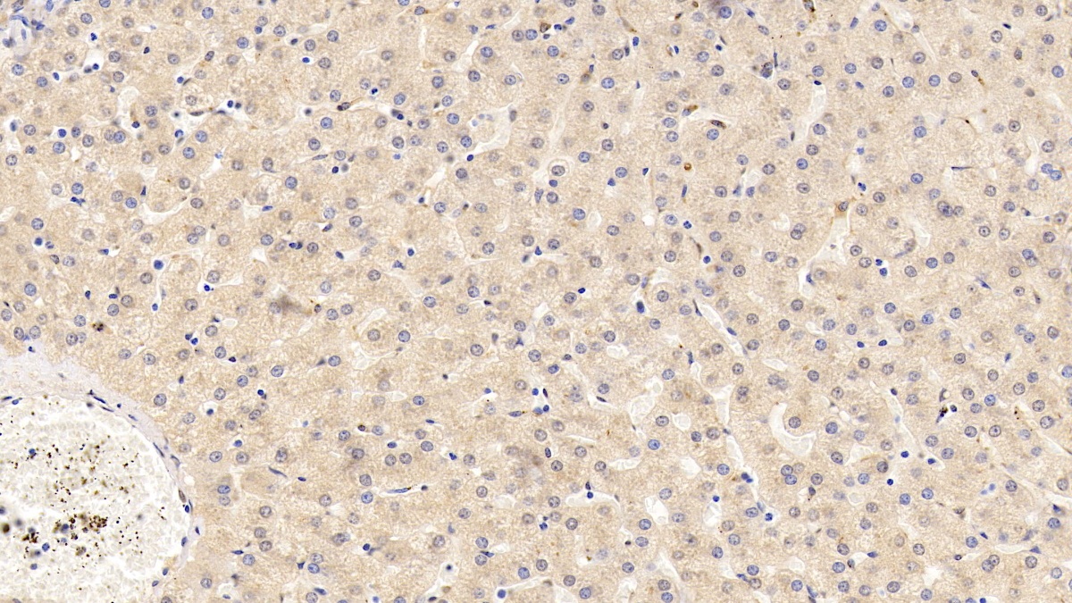 Monoclonal Antibody to Galactosidase Alpha (GLa)