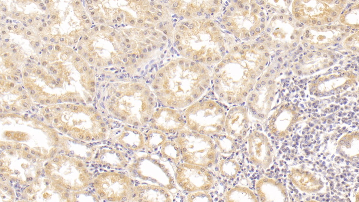 Monoclonal Antibody to Alanine Aminotransferase (ALT)