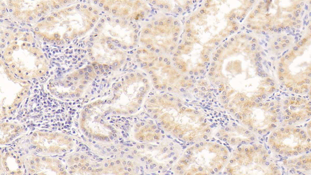 Monoclonal Antibody to Alanine Aminotransferase (ALT)