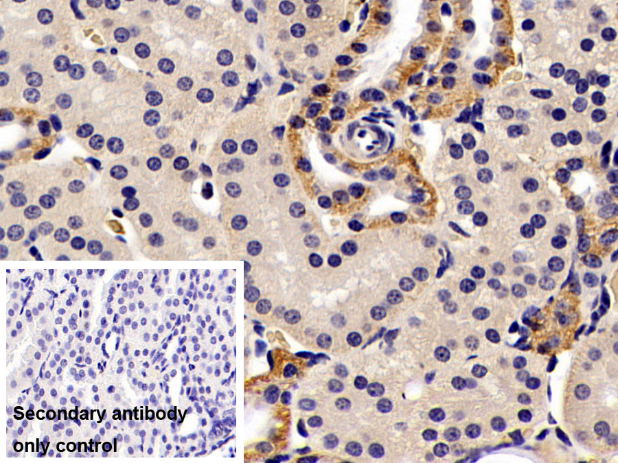 Monoclonal Antibody to Alanine Aminotransferase (ALT)