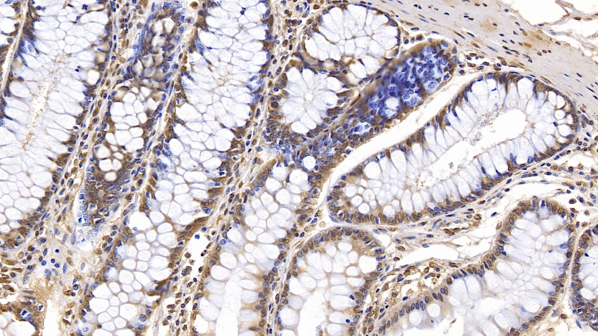 Monoclonal Antibody to Interferon Beta (IFNb)